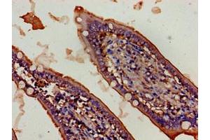 Immunohistochemistry of paraffin-embedded human small intestine tissue using ABIN7152499 at dilution of 1:100 (FBXW2 Antikörper  (AA 72-340))