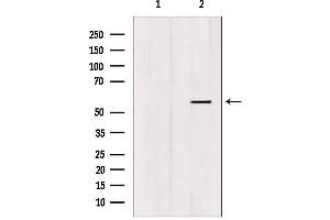 Western blot analysis of extracts from HUVEC, using FOXC1/2 Antibody. (FOXC1 Antikörper)