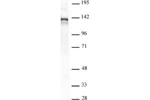 PHF8 pAb tested by Western blot. (PHF8 Antikörper)
