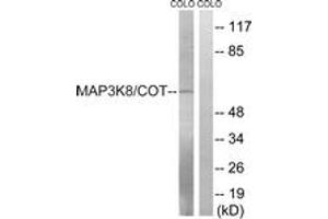 Western blot analysis of extracts from COLO205 cells, treated with Insulin 0. (MAP3K8 Antikörper  (AA 366-415))
