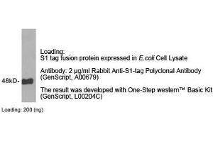 Image no. 1 for anti-S1-Tag antibody (ABIN1573920) (S1-Tag Antikörper)