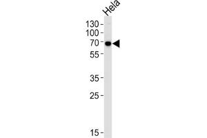 Western Blotting (WB) image for anti-Kinesin Light Chain 1 (KLC1) antibody (ABIN3003845) (KLC1 Antikörper)