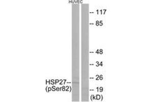 Western blot analysis of extracts from HuvEc cells treated with TNF 20ng/ml 30', using HSP27 (Phospho-Ser82) Antibody. (HSP27 Antikörper  (pSer82))