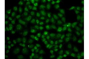 Immunofluorescence analysis of A549 cell using USP26 antibody. (USP26 Antikörper)