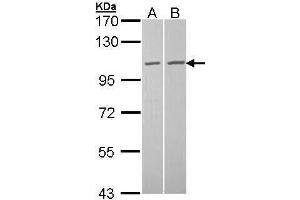 WB Image Sample (30 ug of whole cell lysate) A: A431 , B: Hela 7. (TUBGCP2 Antikörper  (N-Term))