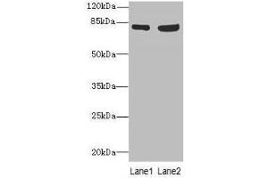 Western blot All lanes: TARS antibody at 4. (TARS Antikörper  (AA 1-230))