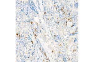 Immunohistochemistry of paraffin-embedded rat spleen using IL27RA Rabbit pAb (ABIN6128083, ABIN6142374, ABIN6142375 and ABIN6224203) at dilution of 1:25 (40x lens). (IL27 Receptor alpha Antikörper  (AA 33-283))