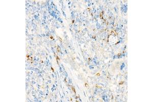 Immunohistochemistry of paraffin-embedded rat spleen using IL27RA Rabbit pAb (ABIN6128083, ABIN6142374, ABIN6142375 and ABIN6224203) at dilution of 1:25 (40x lens).