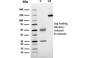 SDS-PAGE Analysis Purified PTH Mouse Recombinant Monoclonal Antibody (rPTH/911). (Rekombinanter PTH Antikörper  (AA 1-34))