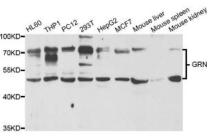 Western blot analysis of extracts of various cell lines, using GRN antibody. (Granulin Antikörper)