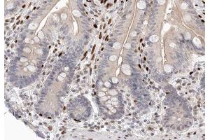 ABIN6266728 at 1/100 staining human colon tissue sections by IHC-P. (CDK2AP2 Antikörper  (C-Term))