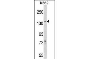 Western blot analysis of hAGL-C371 in K562 cell line lysates (35ug/lane) (AGL Antikörper  (AA 357-387))