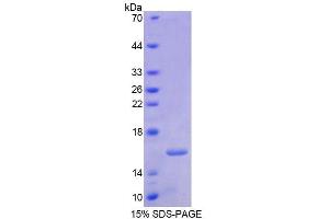 SDS-PAGE analysis of Human RARa Protein. (Retinoic Acid Receptor alpha Protein)