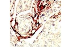 Immunohistochemistry (IHC) image for anti-serine/threonine Kinase 11 (STK11) (AA 14-44) antibody (ABIN3032540)