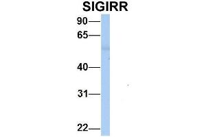 Host:  Rabbit  Target Name:  SIGIRR   Sample Type:  Human Adult Placenta  Antibody Dilution:  1. (SIGIRR Antikörper  (C-Term))