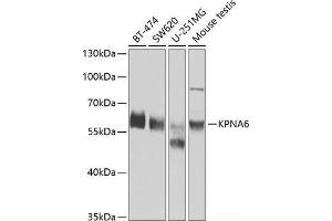 Western blot analysis of extracts of various cell lines using KPNA6 Polyclonal Antibody at dilution of 1:1000. (KPNA6 Antikörper)