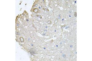 Immunohistochemistry of paraffin-embedded rat brain using CHCHD3 antibody (ABIN5995784) at dilution of 1/100 (40x lens). (CHCHD3 Antikörper)