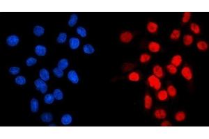 IF analysis of GATA6 using anti-GATA6 antibody (ABIN7599662).