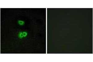 Immunofluorescence analysis of A549 cells, using GPR101 Antibody. (GPR101 Antikörper  (AA 245-294))