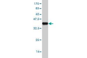 Western Blot detection against Immunogen (37. (DPYD Antikörper  (AA 1-110))