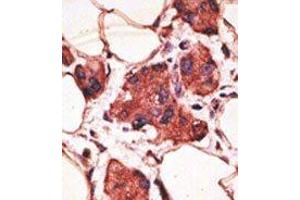 Image no. 2 for anti-Melanoma Antigen Family A, 9 (MAGEA9) (Middle Region) antibody (ABIN358651)
