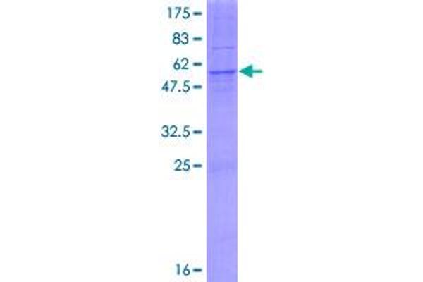 AGPAT1 Protein (AA 1-283) (GST tag)