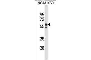 Western blot analysis in NCI-H460 cell line lysates (35ug/lane). (Keratin 6B Antikörper  (AA 207-236))