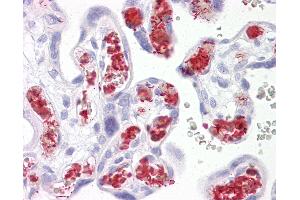 Anti-TBKBP1 antibody IHC of human placenta.