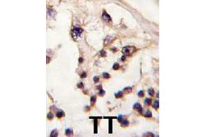Formalin-fixed and paraffin-embedded human testis tissue reacted with TESK2 polyclonal antibody  , which was peroxidase-conjugated to the secondary antibody, followed by DAB staining. (TESK2 Antikörper  (Internal Region))