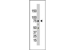 The PRMT5 polyclonal antibody  is used in Western blot to detect PRMT5 in HL-60 cell lysate. (PRMT5 Antikörper  (C-Term))