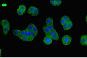 Immunofluorescent analysis of HepG2 cells using ABIN7145231 at dilution of 1:100 and Alexa Fluor 488-congugated AffiniPure Goat Anti-Rabbit IgG(H+L) (BBS1 Antikörper  (AA 217-417))