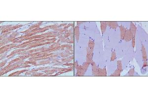 Immunohistochemical analysis of paraffin-embedded human skeletal muscle (left) and cardiac muscle (right) using MYL3 mouse mAb with DAB staining. (MYL3/CMLC1 Antikörper)