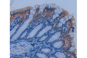 Used in DAB staining on fromalin fixed paraffin- embedded Kidney tissue (CD7 Antikörper  (AA 24-150))