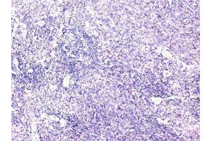 IHC analysis of cortactin using anti-cortactin antibody (ABIN6719306).
