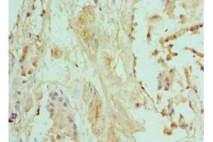 Immunohistochemistry of paraffin-embedded human prostate tissue using ABIN7145331 at dilution of 1:100 (BNIP3 Antikörper  (AA 1-164))