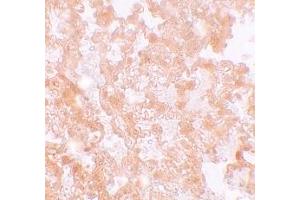 Immunohistochemistry (IHC) image for anti-Major Facilitator Superfamily Domain Containing 2A (MFSD2A) (C-Term) antibody (ABIN1030518)