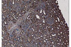 Immunohistochemistry (IHC) image for anti-SET Nuclear Oncogene (SET) (N-Term) antibody (ABIN184618)