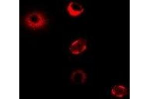 Immunofluorescent analysis of CPT1A staining in MCF7 cells. (CPT1A Antikörper)