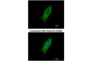 ICC/IF Image Immunofluorescence analysis of methanol-fixed HeLa, using HLA-DPA1, antibody at 1:500 dilution. (HLA-DPA1 Antikörper)