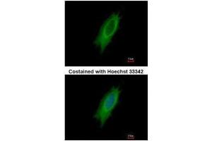 ICC/IF Image Immunofluorescence analysis of methanol-fixed HeLa, using HLA-DPA1, antibody at 1:500 dilution.