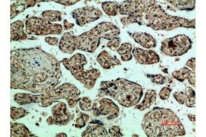Immunohistochemical analysis of paraffin-embedded human-placenta, antibody was diluted at 1:200 (VEGFR2/CD309 Antikörper  (AA 1268-1341))