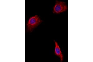 ABIN6257551 and ABIN6275682 staining HepG2 by IF/ICC. (WASF2 Antikörper  (Internal Region))