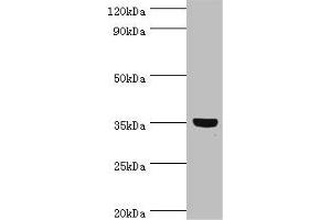 Western blot All lanes: GLYATL1 antibody at 8 μg/mL + Rat liver tissue Secondary Goat polyclonal to rabbit IgG at 1/10000 dilution Predicted band size: 36, 39 kDa Observed band size: 36 kDa (GLYATL1 Antikörper  (AA 1-302))