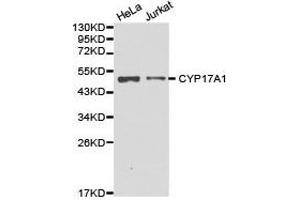 Western Blotting (WB) image for anti-Cytochrome P450, Family 17, Subfamily A, Polypeptide 1 (CYP17A1) antibody (ABIN1872155) (CYP17A1 Antikörper)
