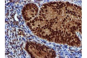 Image no. 1 for anti-EPM2A (Laforin) Interacting Protein 1 (EPM2AIP1) antibody (ABIN1498045) (EPM2AIP1 Antikörper)
