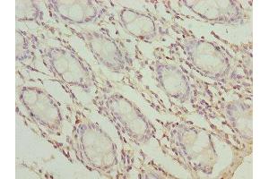 Immunohistochemistry of paraffin-embedded human colon tissue using ABIN7173261 at dilution of 1:100
