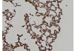 ABIN6269224 at 1/100 staining Mouse lung tissue by IHC-P. (IRS1 Antikörper)