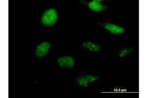 Immunofluorescence of purified MaxPab antibody to NKX2-8 on HeLa cell. (NKX2-8 Antikörper  (AA 1-239))