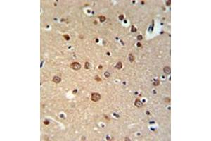 Immunohistochemistry analysis in formalin fixed and paraffin embedded brain tissue reacted with PDE6C Antibody (Center) followed by peroxidase conjugation of the secondary antibody and DAB staining.