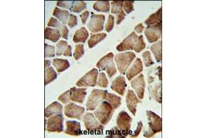 Formalin-fixed and paraffin-embedded human skeletal muscle reacted with ATP5C1 Antibody (N-term), which was peroxidase-conjugated to the secondary antibody, followed by DAB staining. (ATP5C1 Antikörper  (N-Term))
